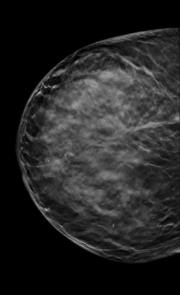 mammographie-principe